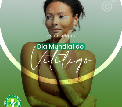 CEMPES-_25_–_Dia_Mundial_do_Vitiligo